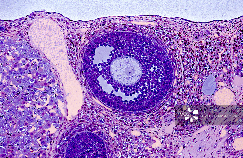 卵巢卵泡显微照片图片素材