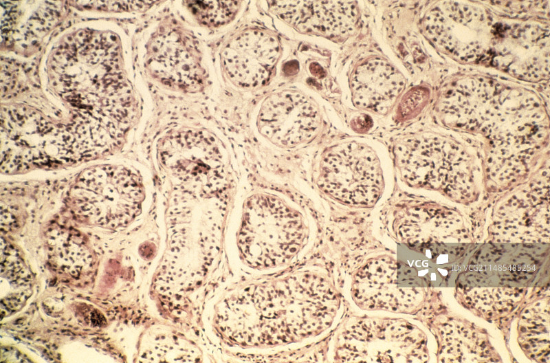 血吸虫卵，光学显微照片图片素材