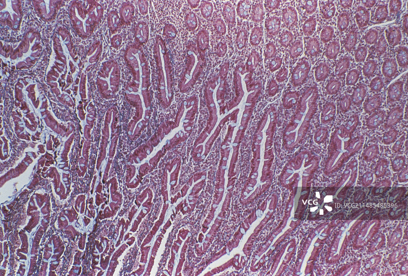 小肠黏膜图片素材