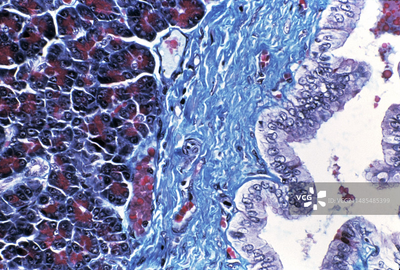 胰腺组织图片素材