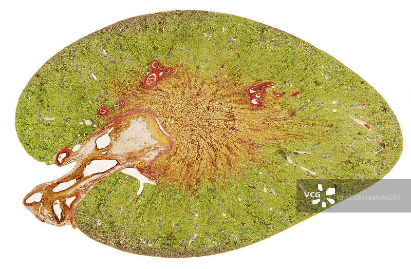 肾脏显微照片图片素材