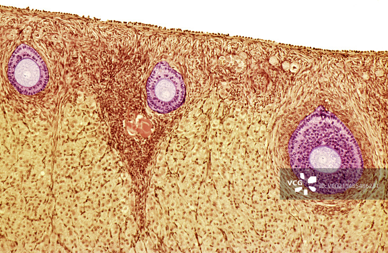 卵巢卵泡显微照片图片素材