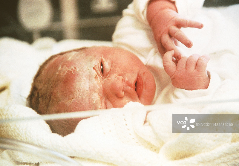 新生的婴儿图片素材