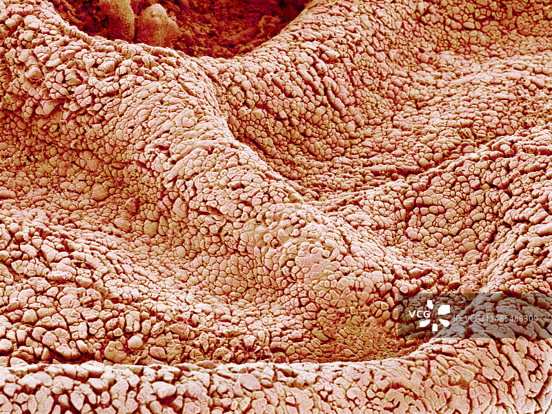 羊膜表面扫描电镜图图片素材