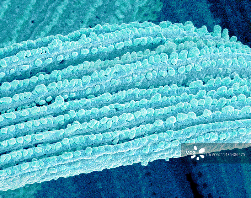 眼睛镜片，扫描电子显微镜图片素材