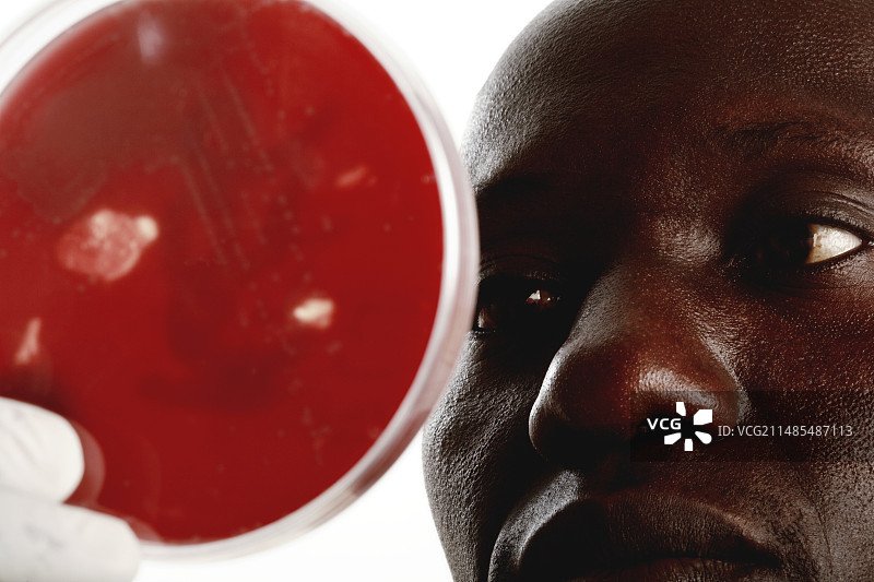 葡萄球菌研究图片素材