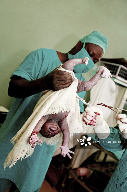 剖腹产图片素材