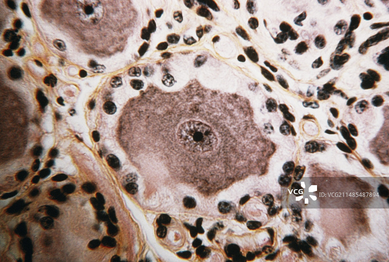 脊神经节图片素材