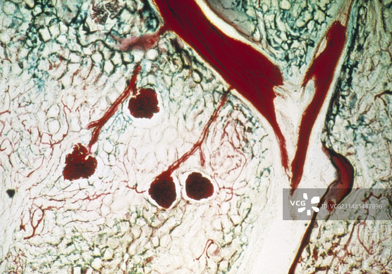 肾脏血管图片素材