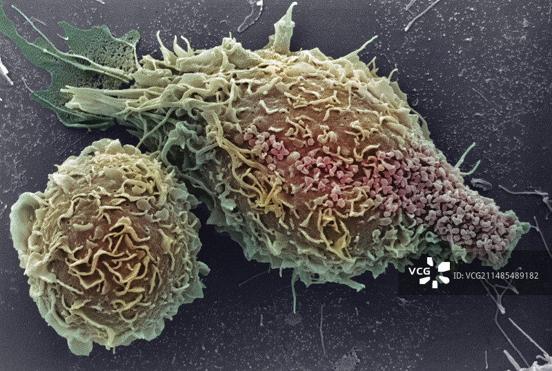 巨噬细胞,扫描电镜图片素材