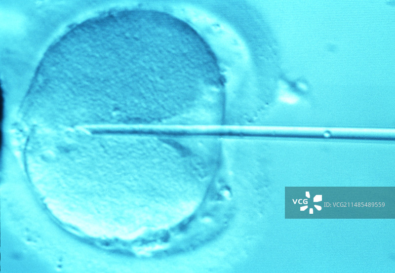 体外受精卵胞浆内单精子注射技术图片素材