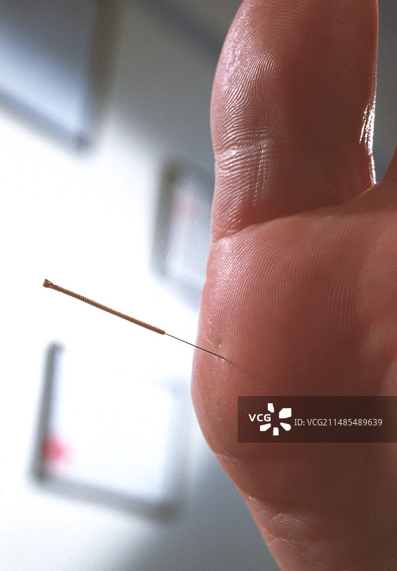针灸图片素材