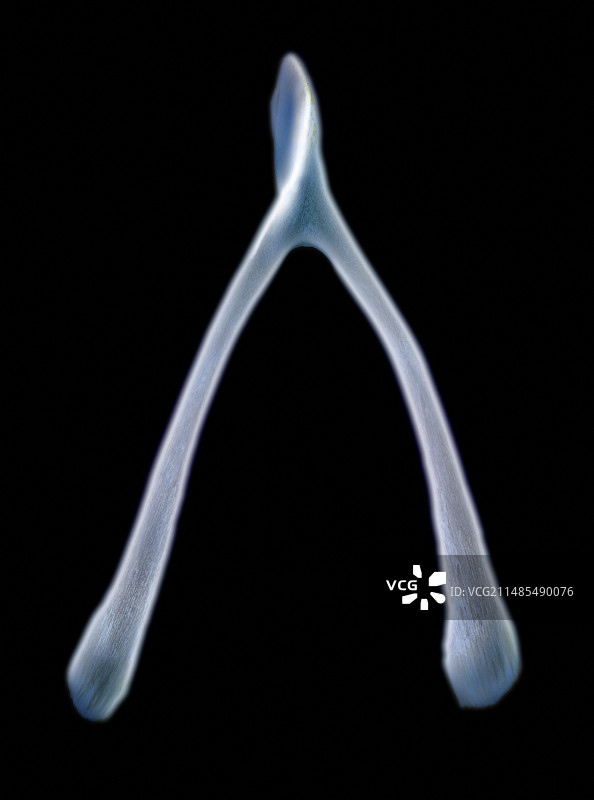 叉骨X光片图片素材