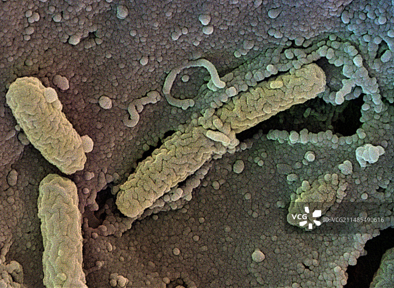 食物细菌扫描电镜图图片素材