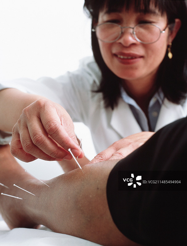 针灸图片素材
