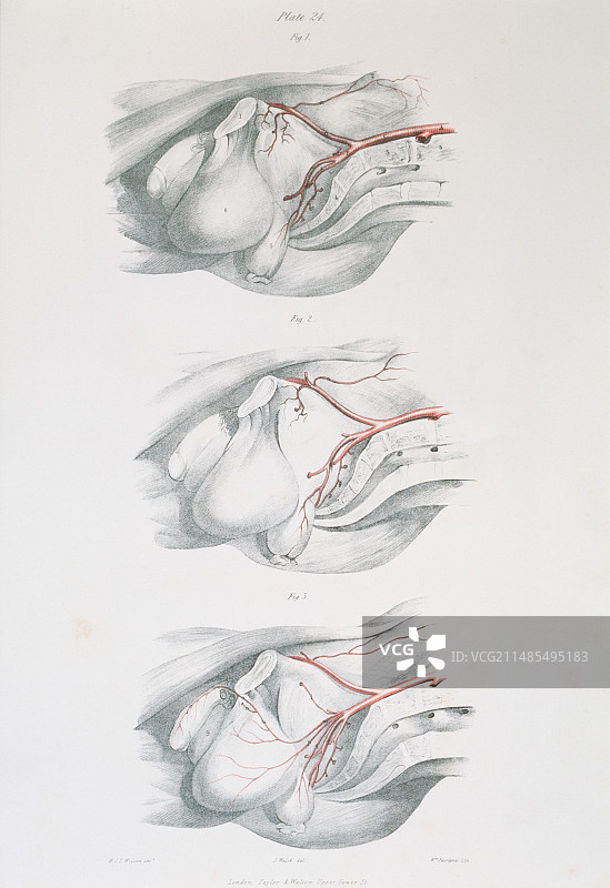 骨盆动脉图片素材