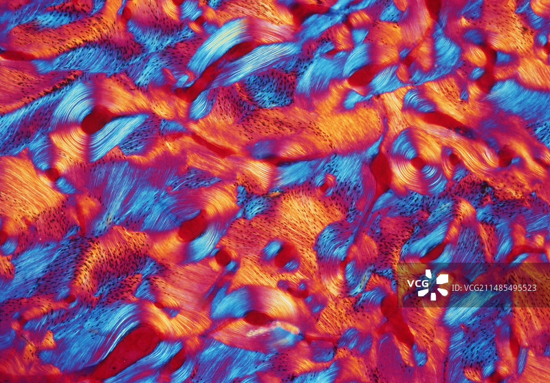 致密骨图片素材