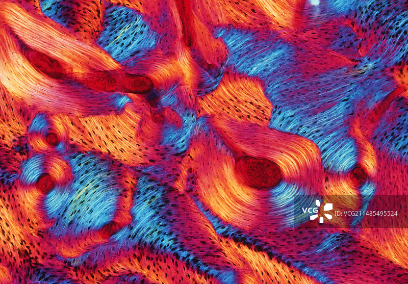 致密骨图片素材