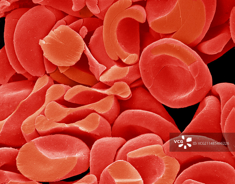 红细胞扫描电子显微镜图像图片素材