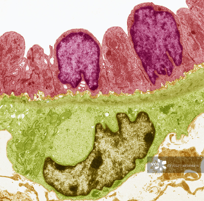 高内皮静脉，TEM图片素材