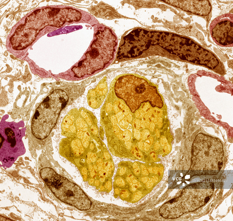 神经血管束，TEM图片素材
