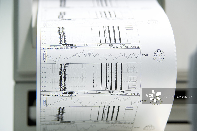 脑电波监视器图片素材