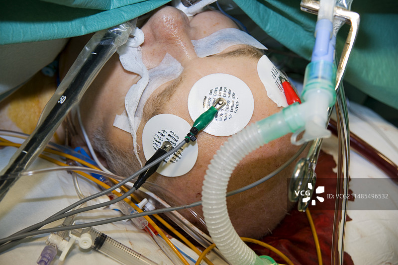 心脏手术图片素材