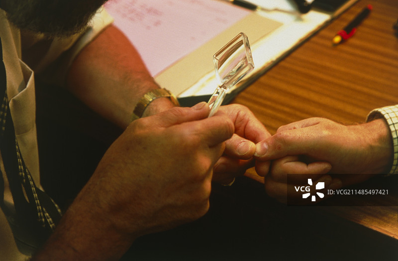 治疗后的疣检查图片素材