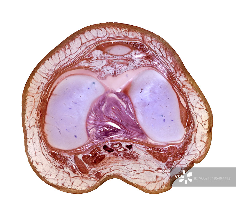 膝关节图片素材