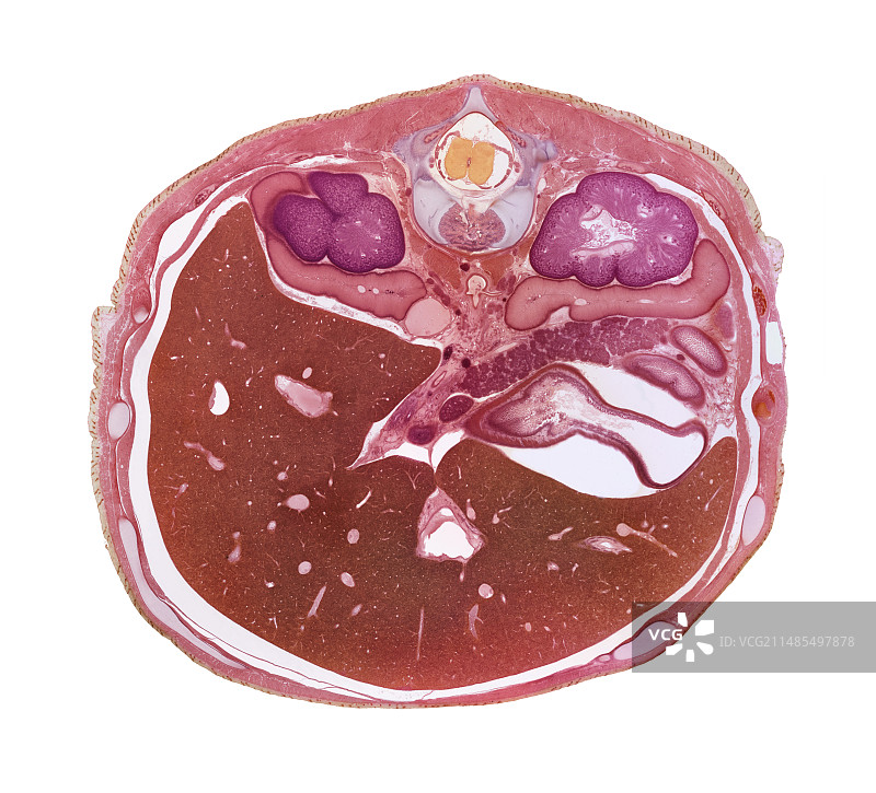胎儿肝脏图片素材
