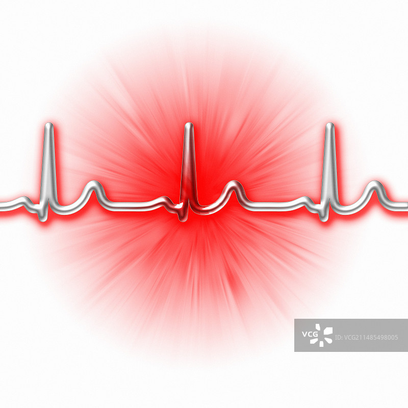 正常心率的心电图图片素材