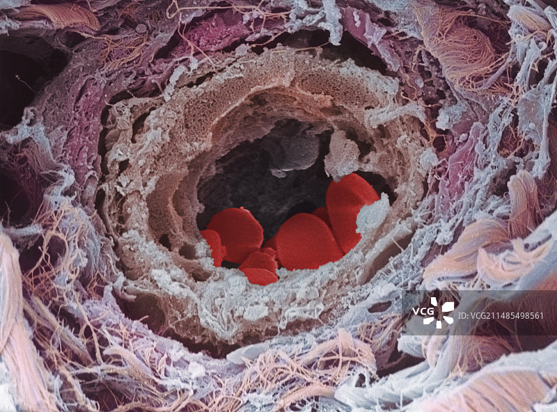 血管图片素材