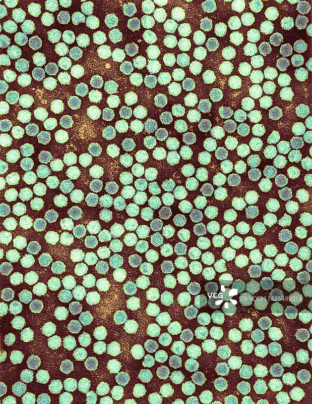 鸭茅花叶病毒，TEM图片素材