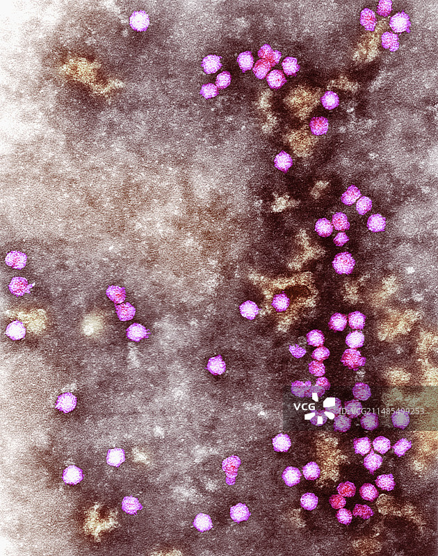 豌豆皱纹花叶病毒,电镜图图片素材