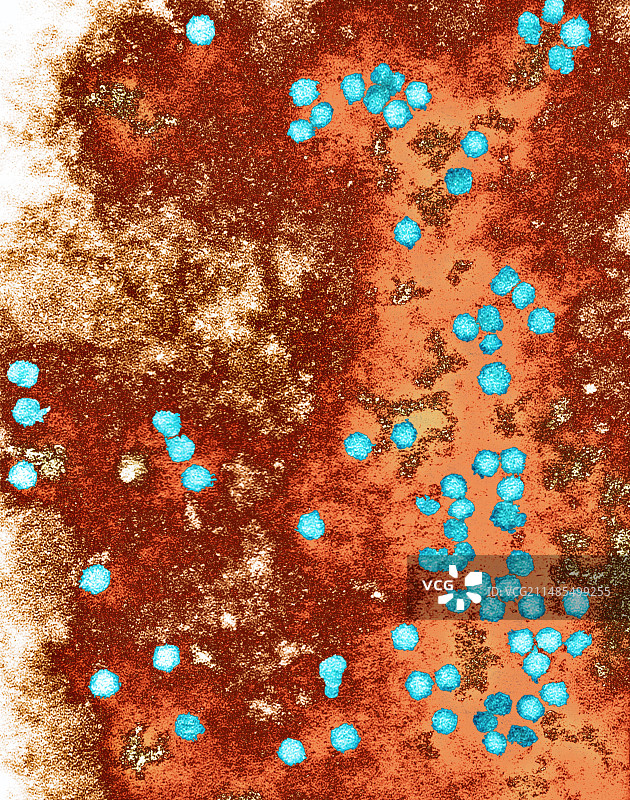 豌豆皱纹花叶病毒,电镜图图片素材