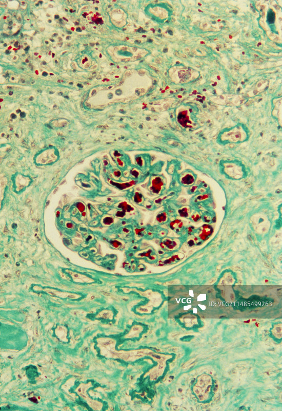 肾小球图片素材