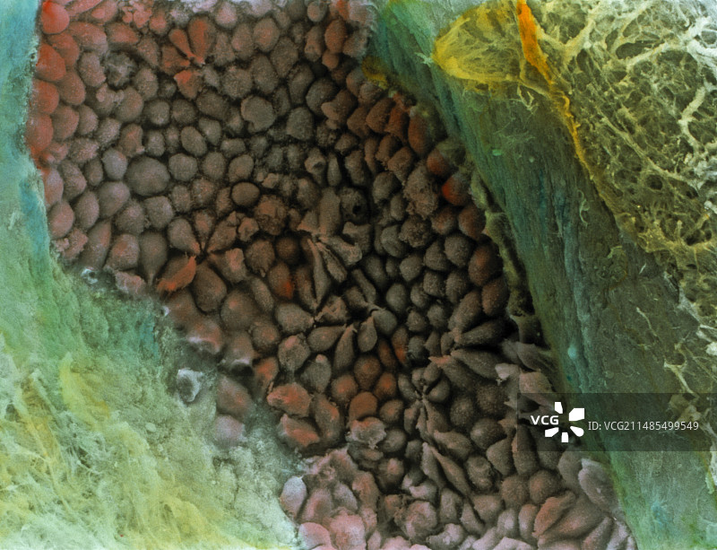 更年期卵巢图片素材