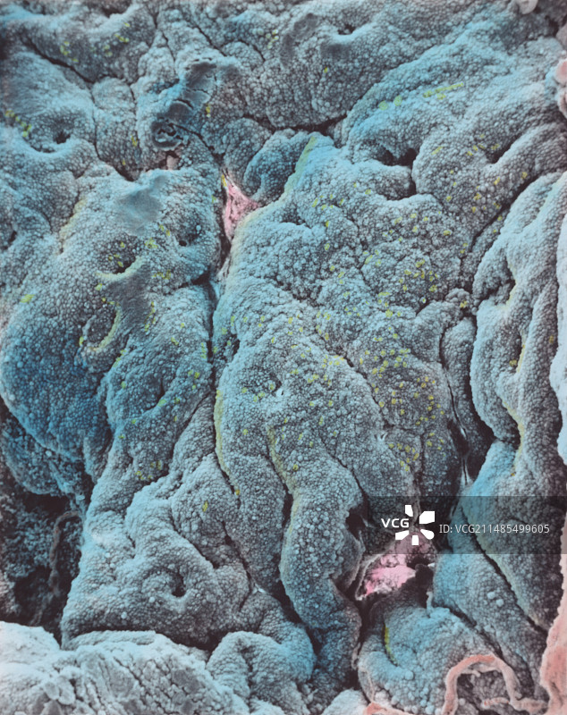 子宫内膜图片素材