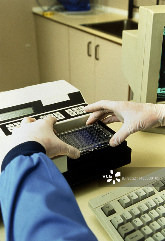 艾滋病血液检测图片素材