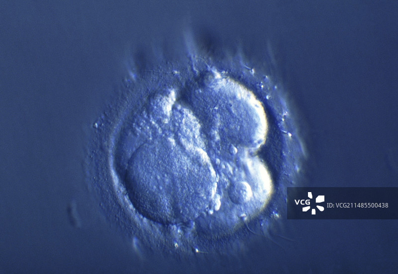 四细胞胚胎的卵裂球光镜图图片素材