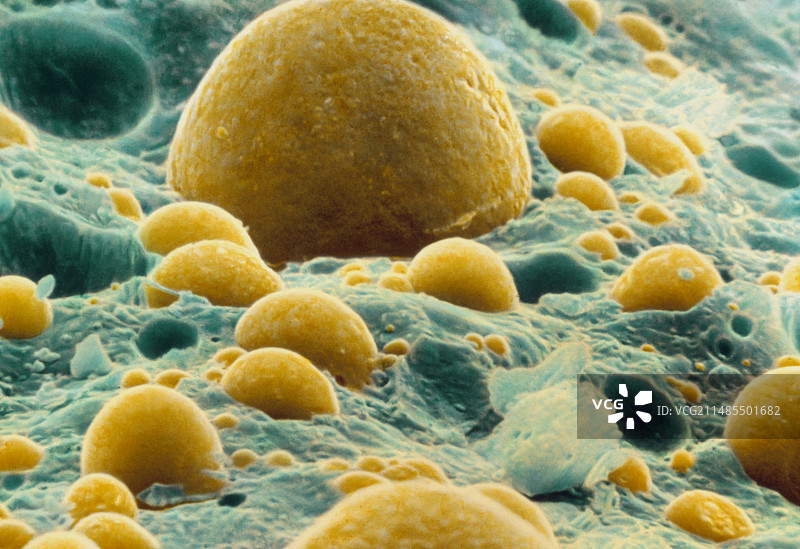 蓝色奶酪沙拉酱的彩色扫描电镜图图片素材