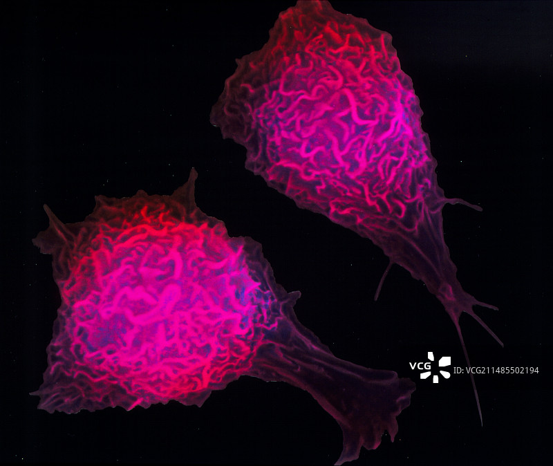 活跃巨噬细胞的彩色扫描电镜图像图片素材