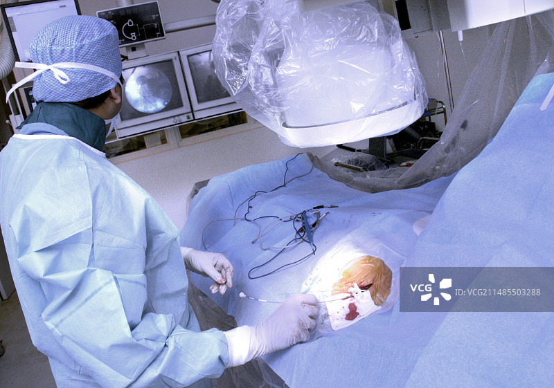 心脏起搏器手术图片素材