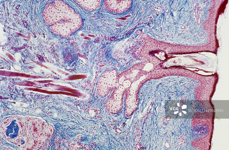 人体皮肤切片，光学显微照片图片素材