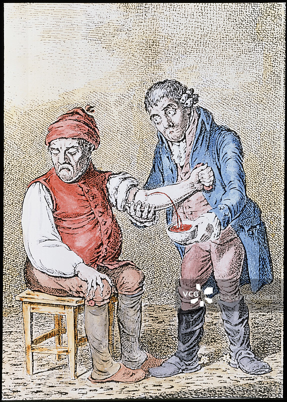 医生为病人放血的艺术作品图片素材