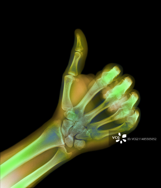 点赞手部的彩色X光片图片素材