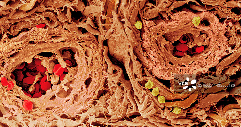 皮肤血管的彩色扫描电镜图图片素材