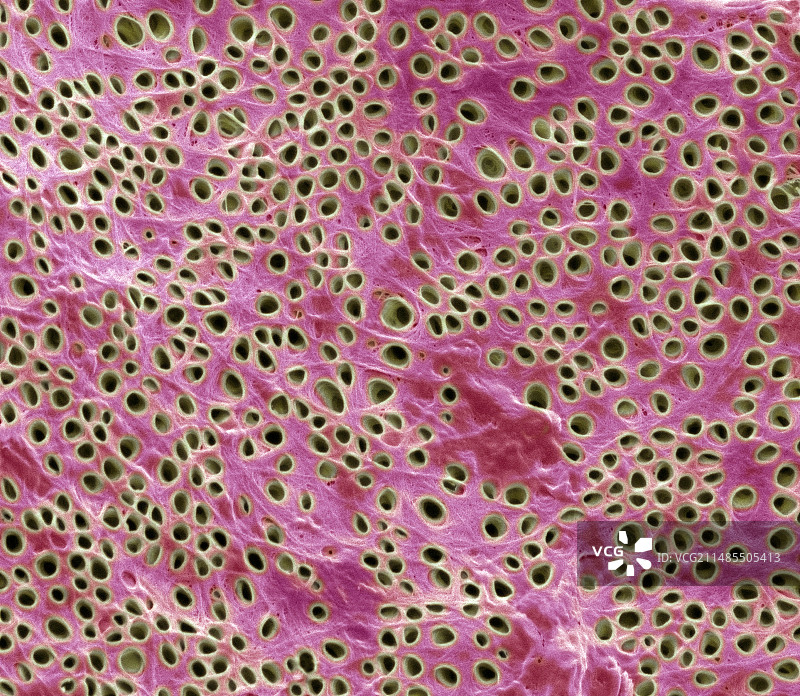 牙齿牙本质扫描电镜图图片素材