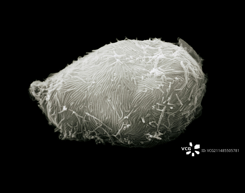 感染HIV的突变血细胞表面的SEM图片素材