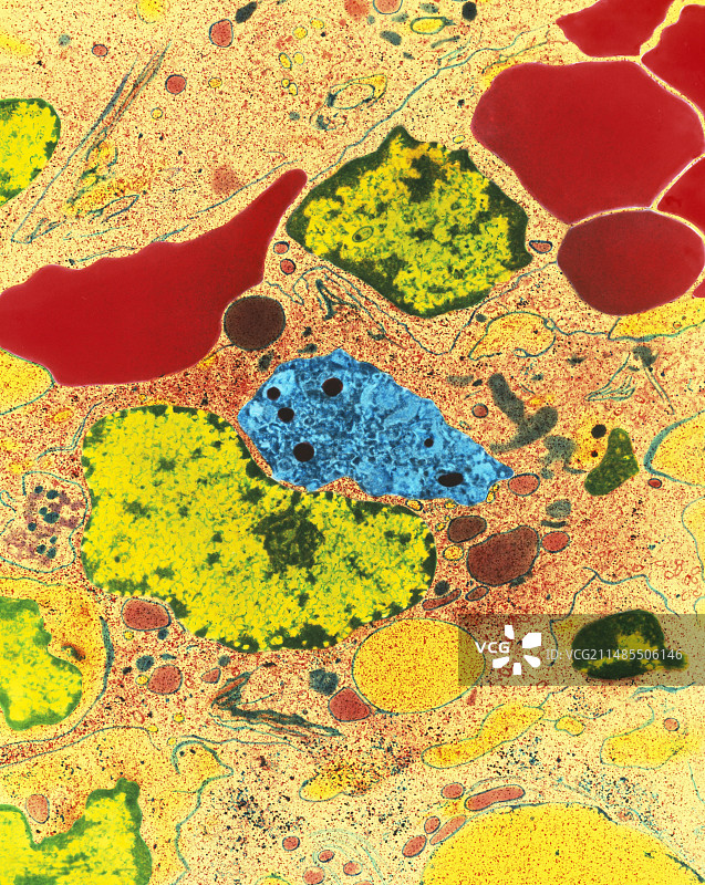 脾脏内巨噬细胞彩色透射电镜图图片素材